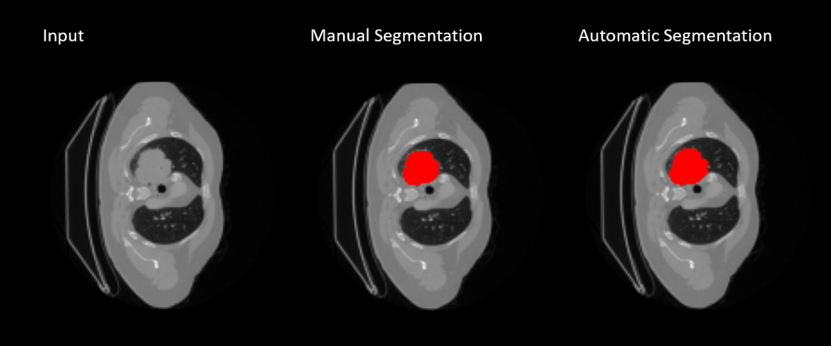 MIP Medical Image processing